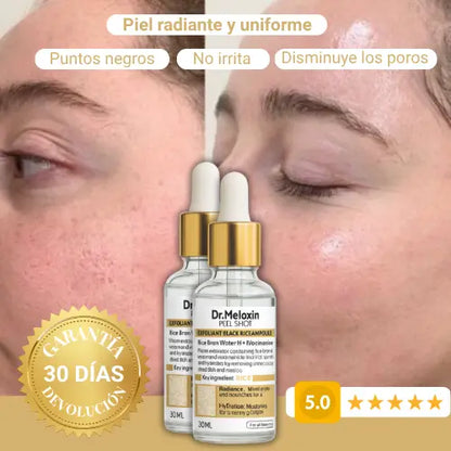 Serum Exfoliante de Arroz Blanco– Dr. Meloxin